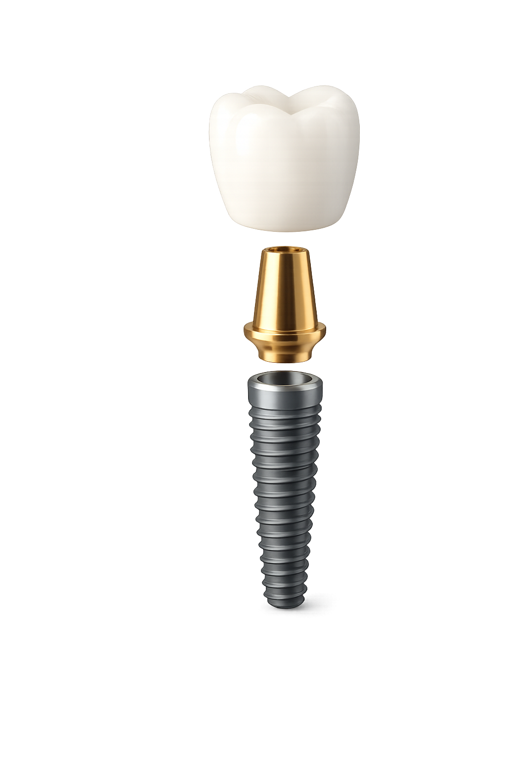 Implant, abutment and crown